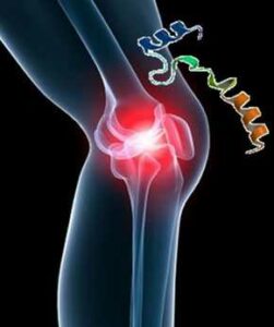 Esquema de una rodilla con dolor artrítico junto a la molécula de cortistatina